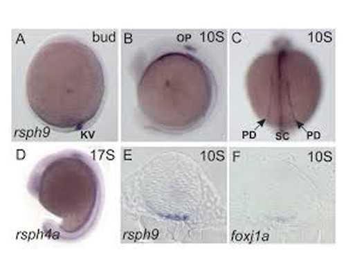 完全双角子宫怀孕_没生孩子切除子宫,2026
天津卵巢早衰试管婴儿排名，供卵助