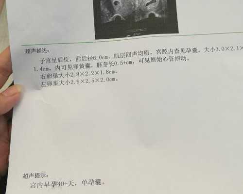 郑州生殖代生服务,郑州供卵喜宝优孕,郑州私人孕代