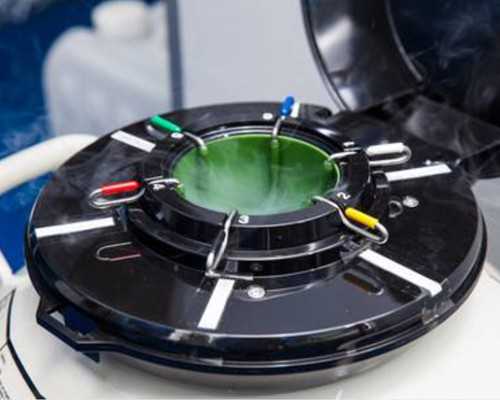 郑州哪家医院有做供卵试管,郑州助孕公司-郑州三代试管医院