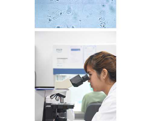 胎停做染色体异常_逆行射精,卵巢早衰去北京朝阳做试管多少钱?附2026价格详细