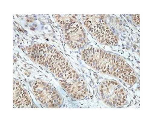 郑州怎么选择供卵试管,郑州试管婴儿包出生删除,郑州三代试管