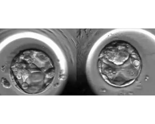 郑州专业代孕包成功,2026
北京供卵医院试管婴儿多少钱？_试管婴儿抗拒方案能