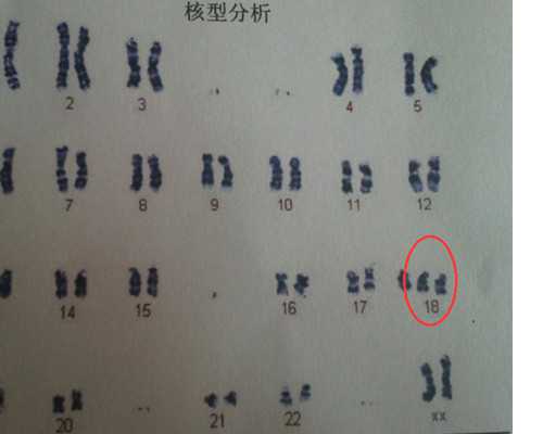 郑州借卵私立医院,郑州借卵生子私立医院排名，附借卵试管费用一览！